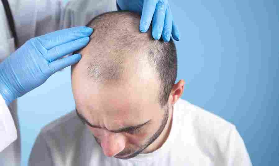Sapphire Hair Clinic – Trusted Hair Transplant Istanbul Clinic